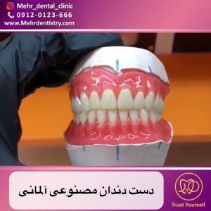 دست دندان مصنوعی (پروتز کامل)