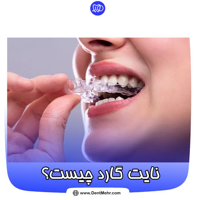 نایت گارد