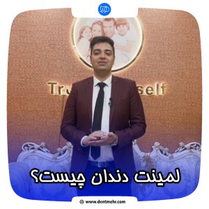 همه چیز در مورد لمینت دندان