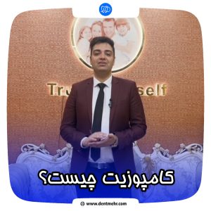 همه چیز در مورد کامپوزیت دندان